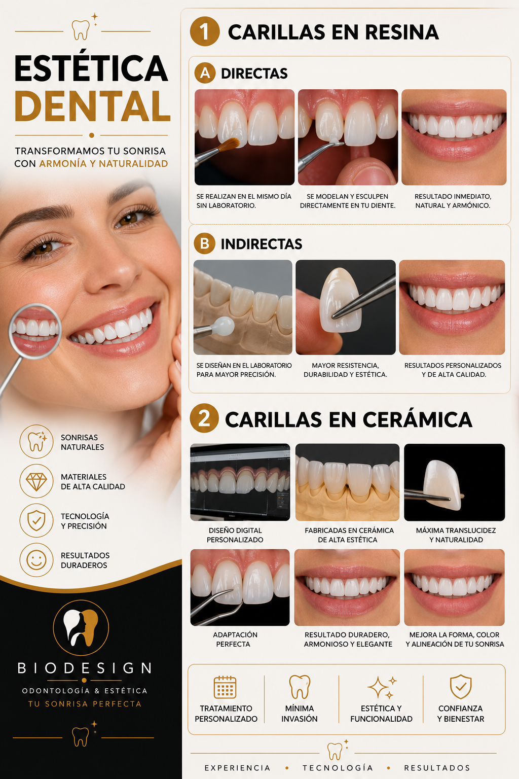 Información — Carillas Estéticas (2)