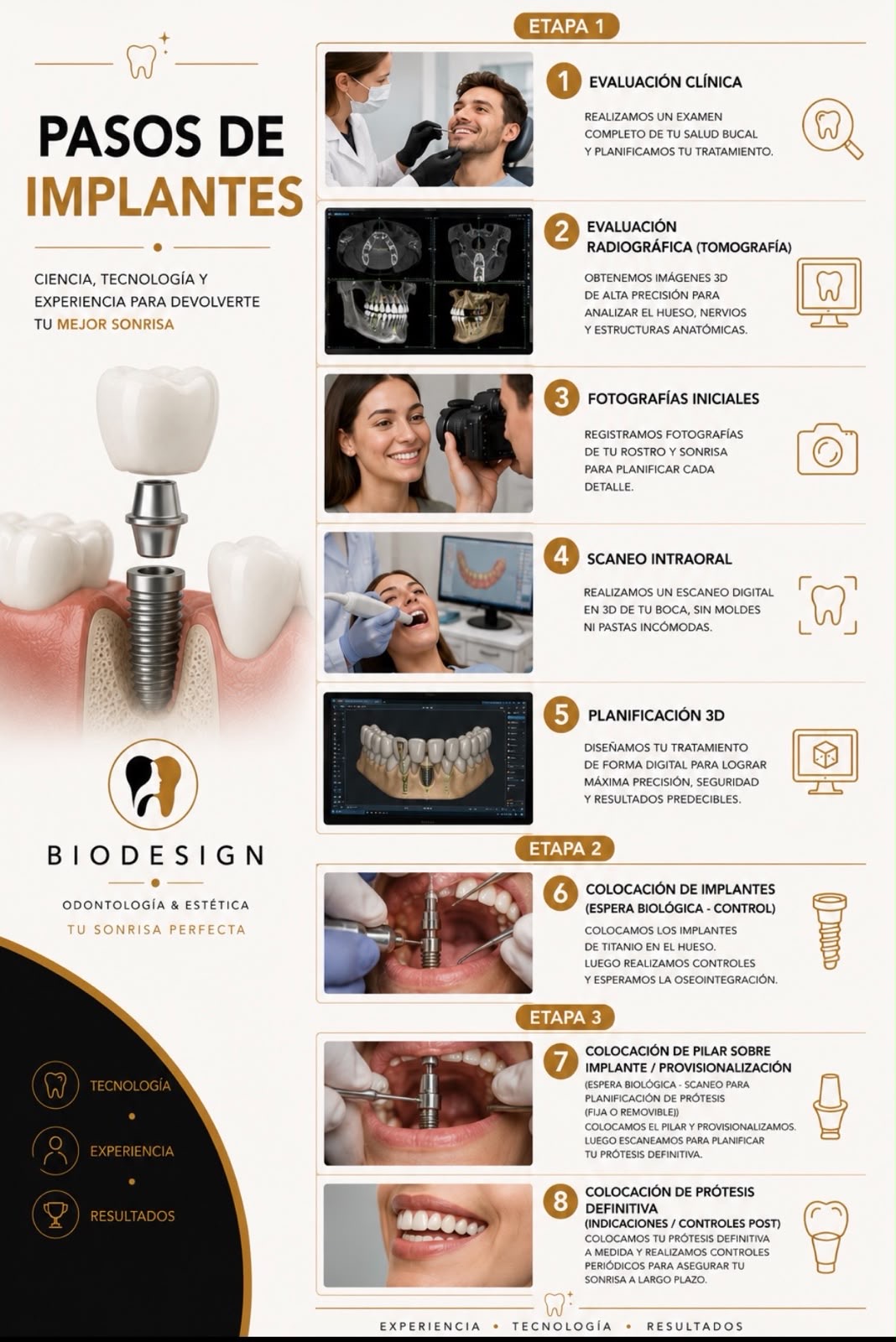 Información — Implantes Dentales (1)