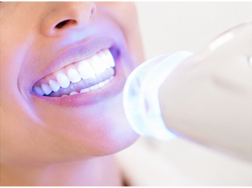Blanqueamiento Dental